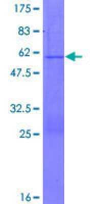 SDS-Page: Recombinant Human PGRMC2 Protein [H00010424-P01] - 12.5% SDS-PAGE Stained with Coomassie Blue.