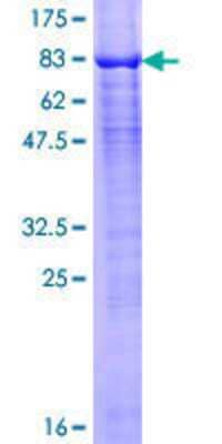 12.5% SDS-PAGE Stained with Coomassie Blue.