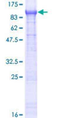 Other Recombinant Human ZER1 GST (N-Term) Protein