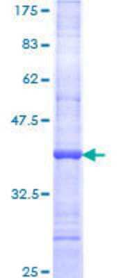 SDS-Page: Recombinant Human LRRN2 Protein [H00010446-Q01] - 12.5% SDS-PAGE Stained with Coomassie Blue.