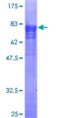 Unknown Recombinant Human TAB1 GST (N-Term) Protein