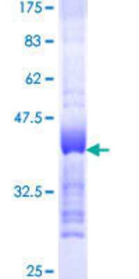 SDS-PAGE Recombinant Human TACC3 GST (N-Term) Protein