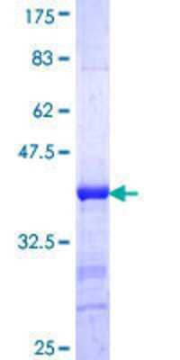 Other Recombinant Human PIBF1 GST (N-Term) Protein