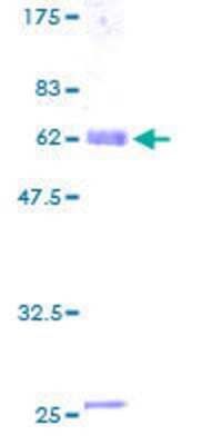12.5% SDS-PAGE Stained with Coomassie Blue.
