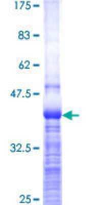 12.5% SDS-PAGE Stained with Coomassie Blue.
