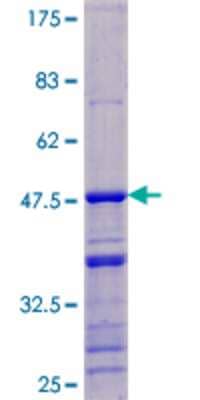 SDS-PAGE Recombinant Human DDX17 GST (N-Term) Protein