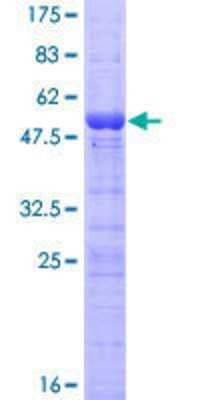 12.5% SDS-PAGE Stained with Coomassie Blue.