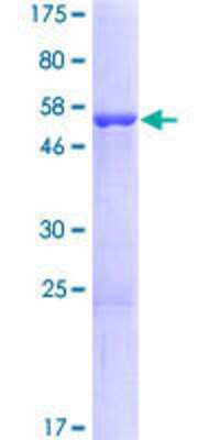 Other Recombinant Human ANP32B GST (N-Term) Protein