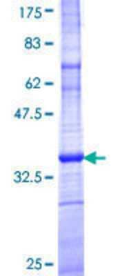 12.5% SDS-PAGE Stained with Coomassie Blue.