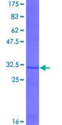 12.5% SDS-PAGE Stained with Coomassie Blue.