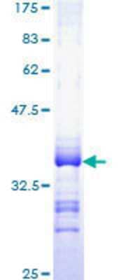 12.5% SDS-PAGE Stained with Coomassie Blue.