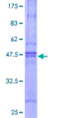 12.5% SDS-PAGE Stained with Coomassie Blue.