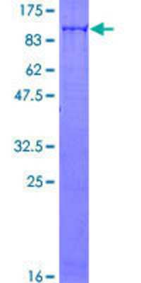 12.5% SDS-PAGE Stained with Coomassie Blue.