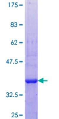 Other Recombinant Human COLEC10 GST (N-Term) Protein