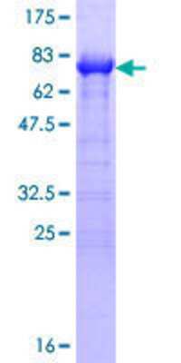 12.5% SDS-PAGE Stained with Coomassie Blue.