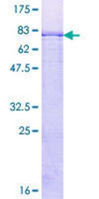 12.5% SDS-PAGE Stained with Coomassie Blue.