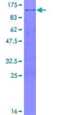 12.5% SDS-PAGE Stained with Coomassie Blue.