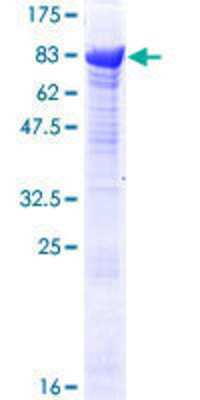 12.5% SDS-PAGE Stained with Coomassie Blue.