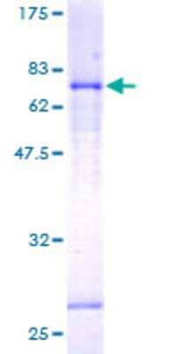 SDS-Page: Recombinant Human Lefty-1 Protein [H00010637-P01] - Stained with Coomassie Blue.