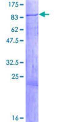 12.5% SDS-PAGE Stained with Coomassie Blue.