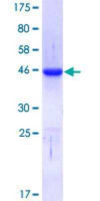 SDS-Page: Recombinant Human CTCF Protein [H00010664-Q01] - 12.5% SDS-PAGE Stained with Coomassie Blue.