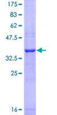 12.5% SDS-PAGE Stained with Coomassie Blue.