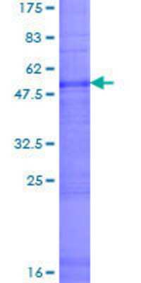 12.5% SDS-PAGE Stained with Coomassie Blue.
