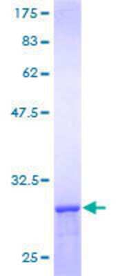 Other Recombinant Human CCT8 GST (N-Term) Protein