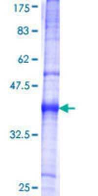 12.5% SDS-PAGE Stained with Coomassie Blue.