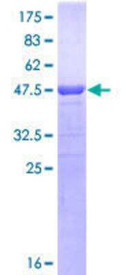 12.5% SDS-PAGE Stained with Coomassie Blue.