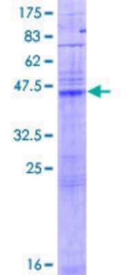 12.5% SDS-PAGE Stained with Coomassie Blue.