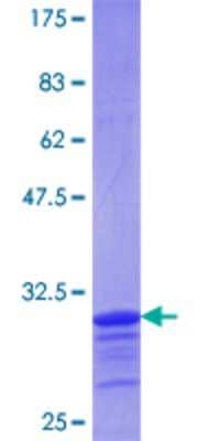 12.5% SDS-PAGE Stained with Coomassie Blue.