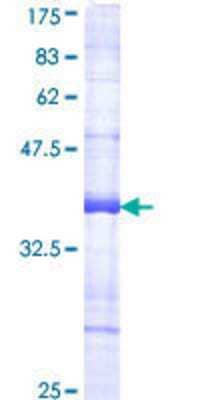 SDS-Page: Recombinant Human PLK4 Protein [H00010733-Q01] - 12.5% SDS-PAGE Stained with Coomassie Blue.