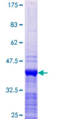 12.5% SDS-PAGE Stained with Coomassie Blue.