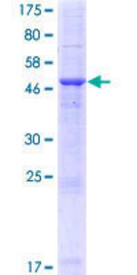 Unknown Recombinant Human PLAC1 GST (N-Term) Protein
