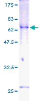 12.5% SDS-PAGE Stained with Coomassie Blue.