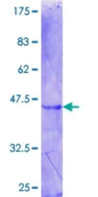 12.5% SDS-PAGE Stained with Coomassie Blue.