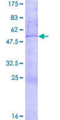 12.5% SDS-PAGE Stained with Coomassie Blue.