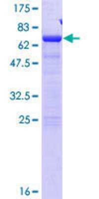 SDS-PAGE Recombinant Human SDCCAG8 GST (N-Term) Protein