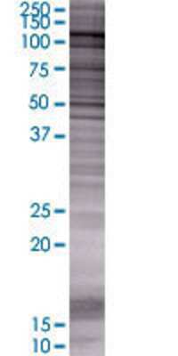 PPP1R13L transfected lysate.