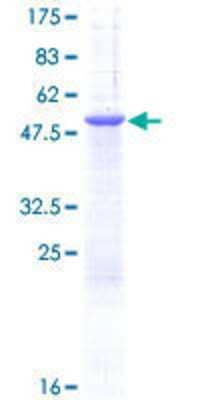 12.5% SDS-PAGE Stained with Coomassie Blue.