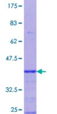 12.5% SDS-PAGE Stained with Coomassie Blue.