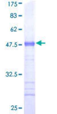 12.5% SDS-PAGE Stained with Coomassie Blue.