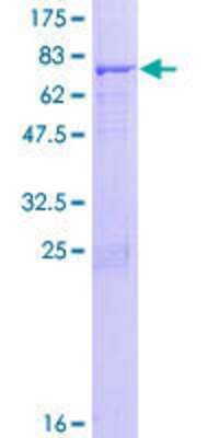 12.5% SDS-PAGE Stained with Coomassie Blue.