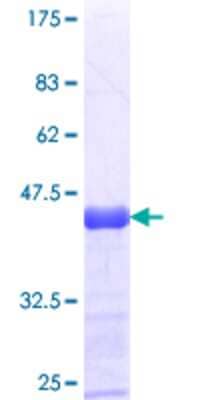 12.5% SDS-PAGE Stained with Coomassie Blue.