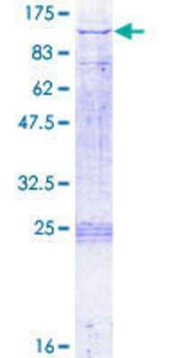 12.5% SDS-PAGE Stained with Coomassie Blue.