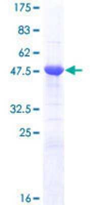 12.5% SDS-PAGE Stained with Coomassie Blue.