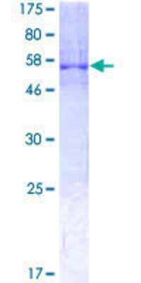 12.5% SDS-PAGE Stained with Coomassie Blue.