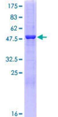 12.5% SDS-PAGE Stained with Coomassie Blue.