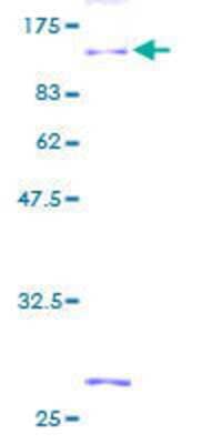 Other Recombinant Human MIG2/Kindlin-2 GST (N-Term) Protein